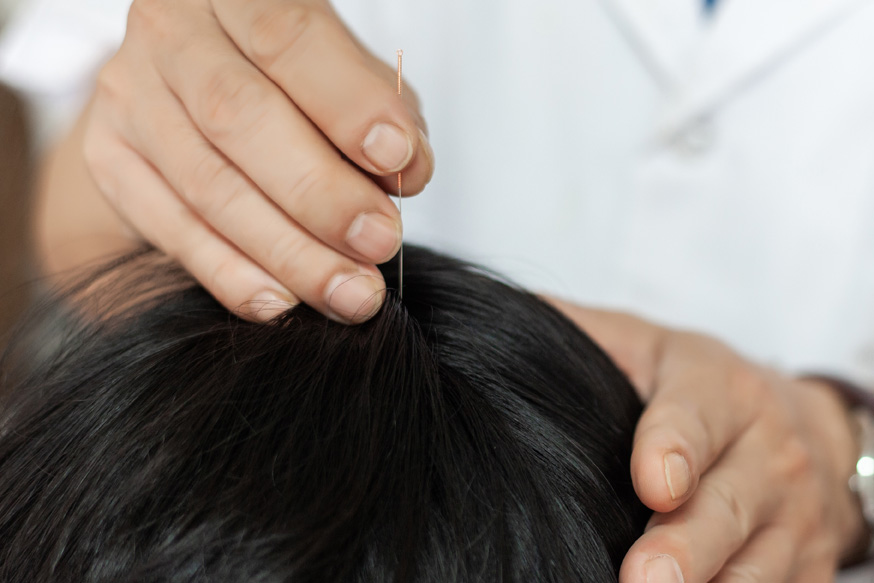 灵枢官针培训班